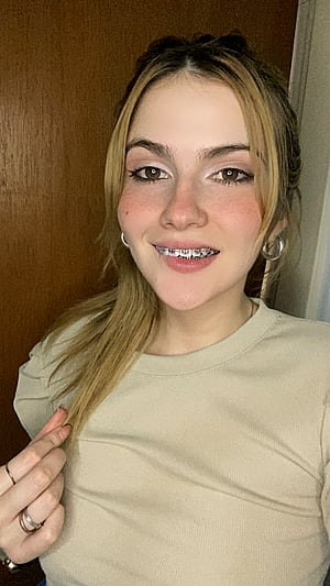 Braces and Sass, Oh My: Grace's Cheeky Little Tease
