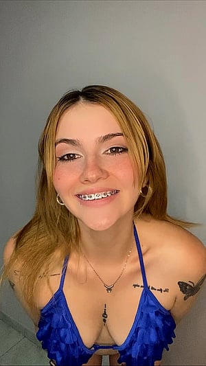 Braces Babe Turning Heads and Getting Rates, Tune In!