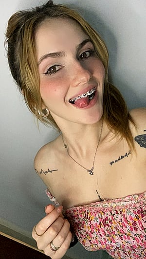 Braces Bonus: My Smile Will Melt You
