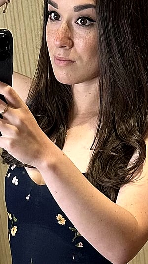 Freckle Fever Cuteness Overload ❤️🌹
