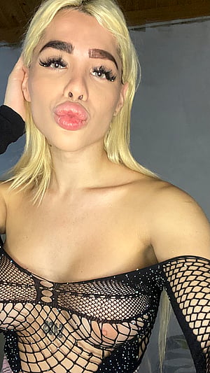 Kiss Placement Tips? 😘