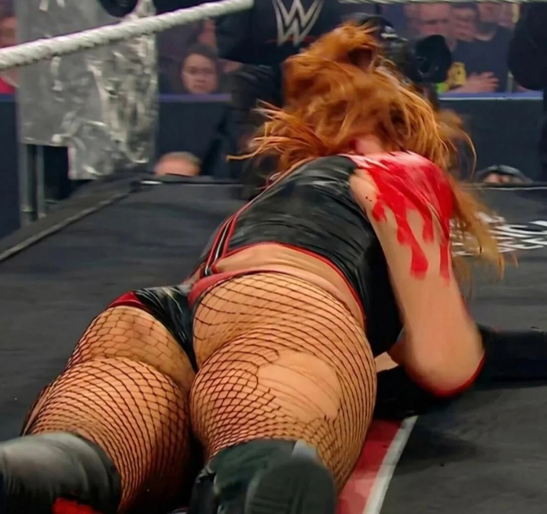 Becky Lynch Stuns in New Snap picture 1 of 1