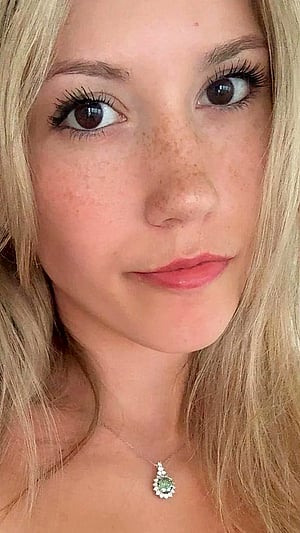 Freckles Popping Out Just for You :)