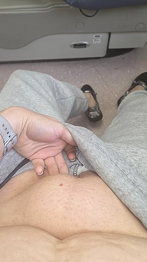 Doc said say ahh, get a load of my fupa instead!