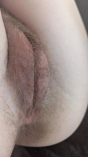 Close-up growing back after a wax~