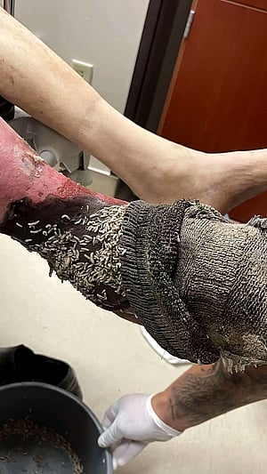 A Patient Who Came In For Pain - Now Look At This