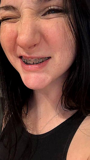 i hope you like my braces as much as you like me ;))