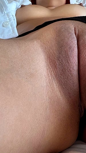 Nipple Freedom Is Just the Beginning